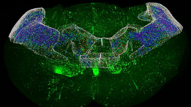 細胞影像平臺圖像處理-Imaris計數專題及全腦計數方案上機培訓通知