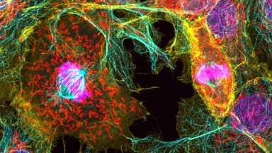 細胞影像平臺 Zeiss LSM980 Airyscan2 快速超分辨激光共聚焦顯微鏡上機培訓通知