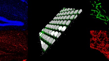 細胞生物學平臺Leica SP8激光共聚焦顯微鏡上機培訓通知