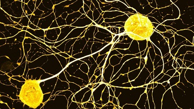 尼康生物影像中心超分辨AX R激光共聚焦顯微鏡上機培訓通知