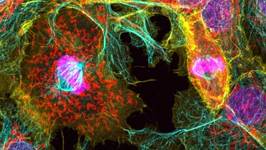 細胞影像平臺Zeiss LSM980 Airyscan2 快速超分辨激光共聚焦顯微鏡上機培訓通知