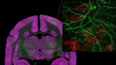 細胞影像平臺Nikon A1R HD25高分辨激光掃描共聚焦顯微鏡培訓通知