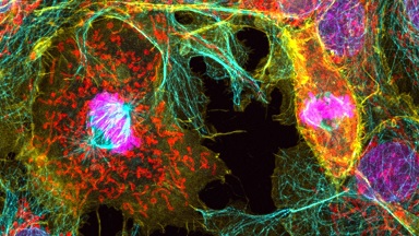 細胞影像平臺Zeiss LSM980 Airyscan2 快速超分辨激光共聚焦顯微鏡上機培訓通知