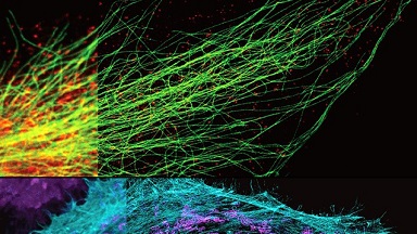 共享儀器平臺STEDYCON超高分辨共聚焦上機培訓通知