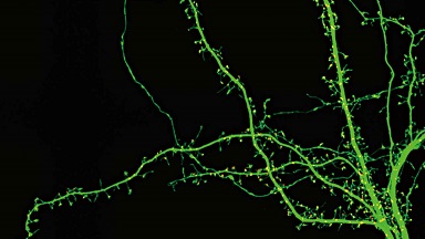 尼康生物影像中心超分辨激光掃描共聚焦顯微鏡上機培訓通知