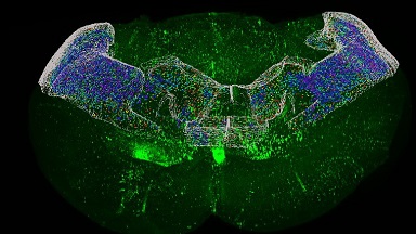 細胞影像平臺圖像處理-顯微圖像計數與共定位專題及全腦計數案例線下上機培訓通知