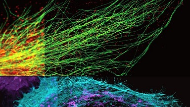 共享儀器平臺STEDYCON超高分辨共聚焦上機培訓通知