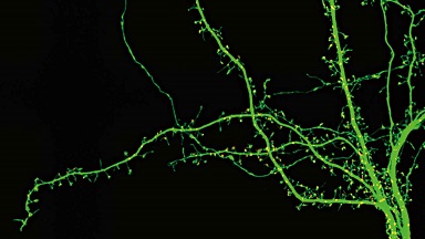 尼康生物影像中心超分辨激光掃描共聚焦顯微鏡上機培訓通知