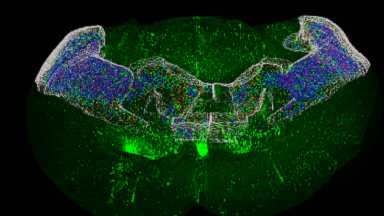 細胞影像平臺顯微圖像處理與案例展示系列（一）培訓通知