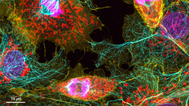 細胞影像平臺Zeiss LSM980 Airyscan2 快速超分辨激光共聚焦顯微鏡培訓通知