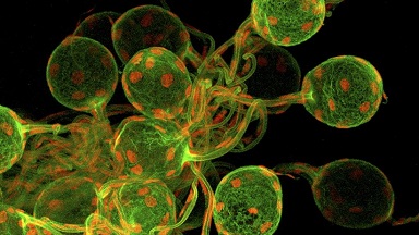 細胞生物學平臺Olympus激光共聚焦顯微鏡FV3000上機培訓通知