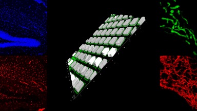 細胞生物學平臺Leica SP8激光共聚焦顯微鏡上機培訓通知