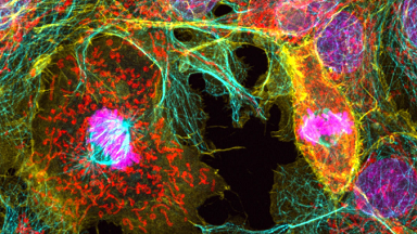 細胞影像平臺Zeiss LSM980 Airyscan2 快速超分辨激光共聚焦顯微鏡培訓通知