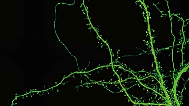 尼康生物影像中心超分辨激光掃描共聚焦顯微鏡上機培訓通知