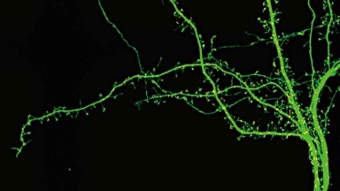 尼康生物影像中心超分辨激光掃描共聚焦顯微鏡上機培訓通知
