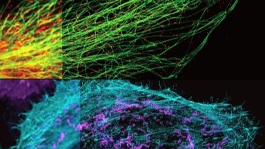 共享儀器平臺STEDYCON超高分辨共聚焦上機培訓通知