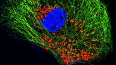 共享儀器平臺Zeiss超高分辨共聚焦顯微鏡LSM880 Airyscan上機培訓通知