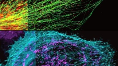 共享儀器平臺STEDYCON超高分辨共聚焦上機培訓通知