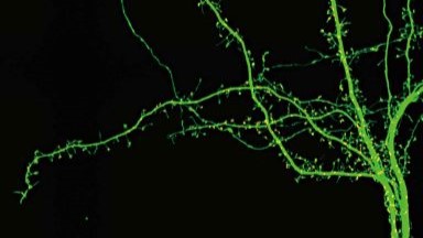 尼康生物影像中心超分辨激光掃描共聚焦顯微鏡上機培訓通知