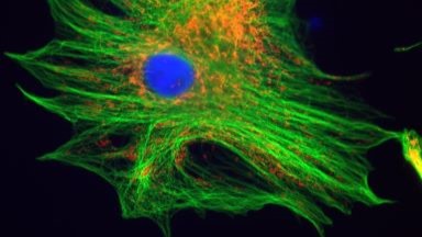 共享儀器平臺Zeiss超高分辨共聚焦顯微鏡LSM880 Airyscan上機培訓通知