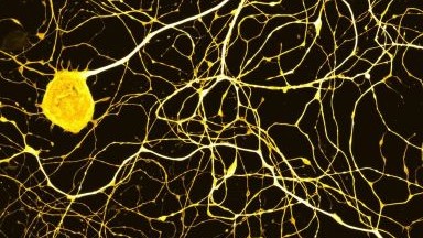 尼康生物影像中心AXR NSPARC 超分辨率激光掃描共聚焦顯微鏡上機培訓通知