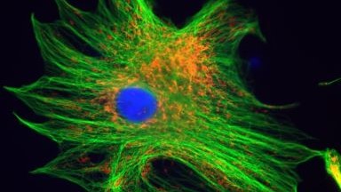 共享儀器平臺Zeiss超高分辨共聚焦顯微鏡LSM880 Airyscan上機培訓通知