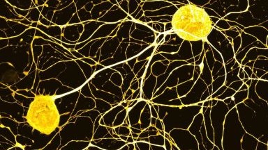 尼康生物影像中心AXR NSPARC 超分辨率激光掃描共聚焦顯微鏡上機培訓通知