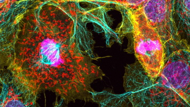 細胞影像平臺Zeiss LSM980 Airyscan2 快速超分辨激光共聚焦顯微鏡培訓通知