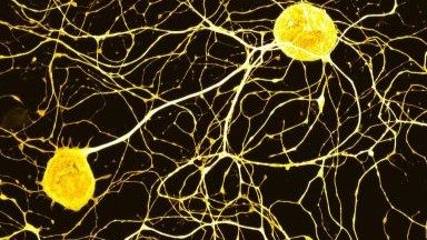 尼康生物影像中心AXR NSPARC 超分辨率激光掃描共聚焦顯微鏡上機培訓通知