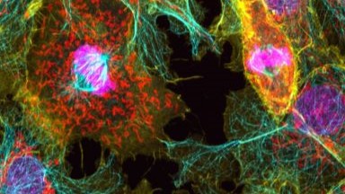 細胞影像平臺Zeiss LSM980 Airyscan2 快速超分辨激光共聚焦顯微鏡培訓通知